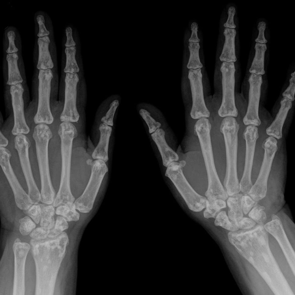 hands-xray